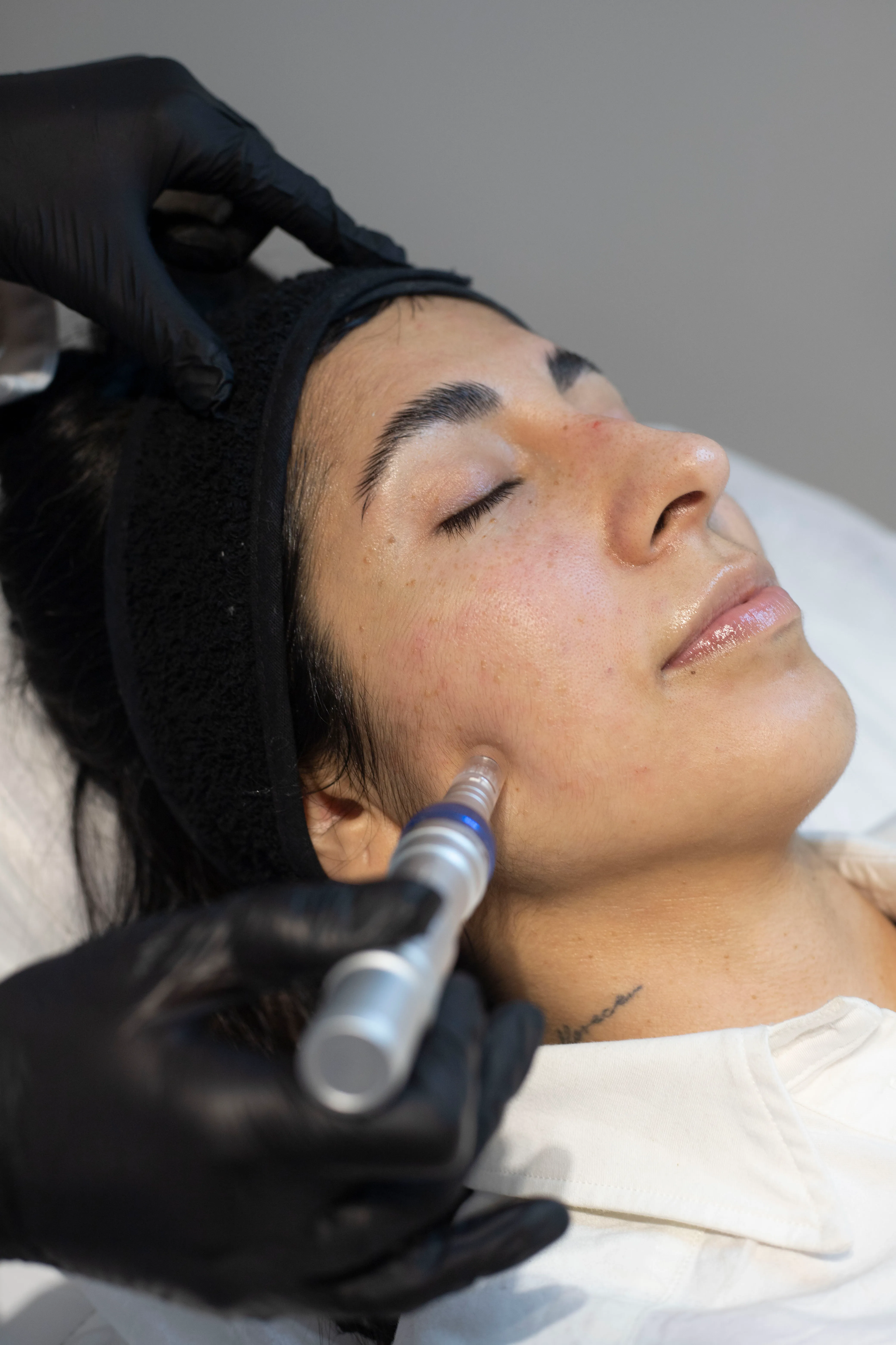 Imagen del tratamiento